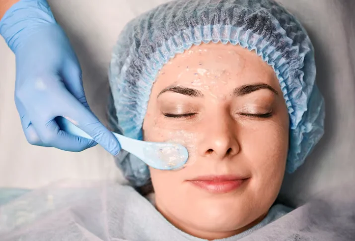 is chemical peel good for skin​